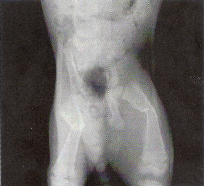 Mặt chụp X-Quang của đuôi và chân sau của chó con.